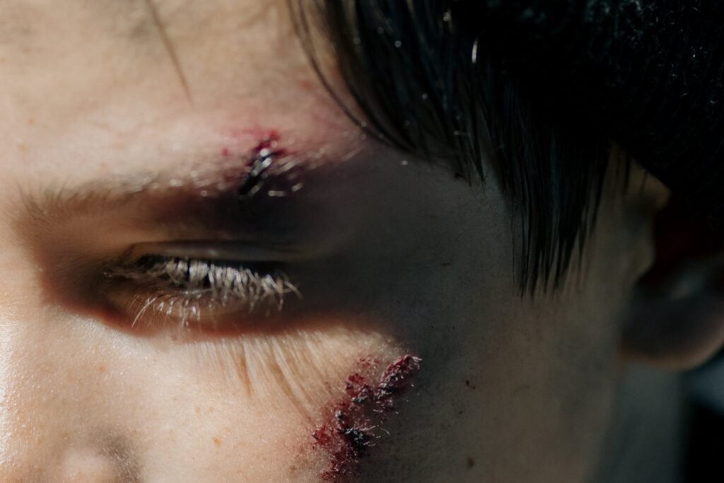 Understanding Personal Injury Claims: What You Need to Know injury claims