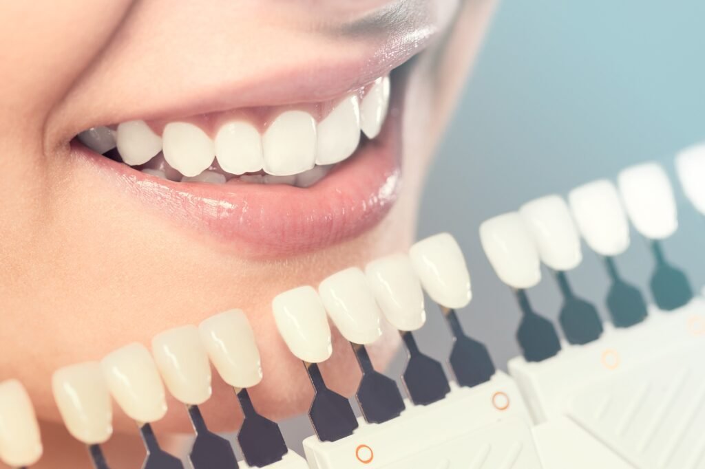 The Dental Tech Replicating Natural Tooth Colour