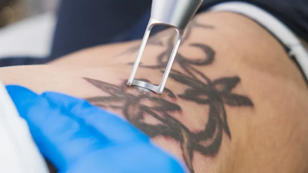 Tattoos